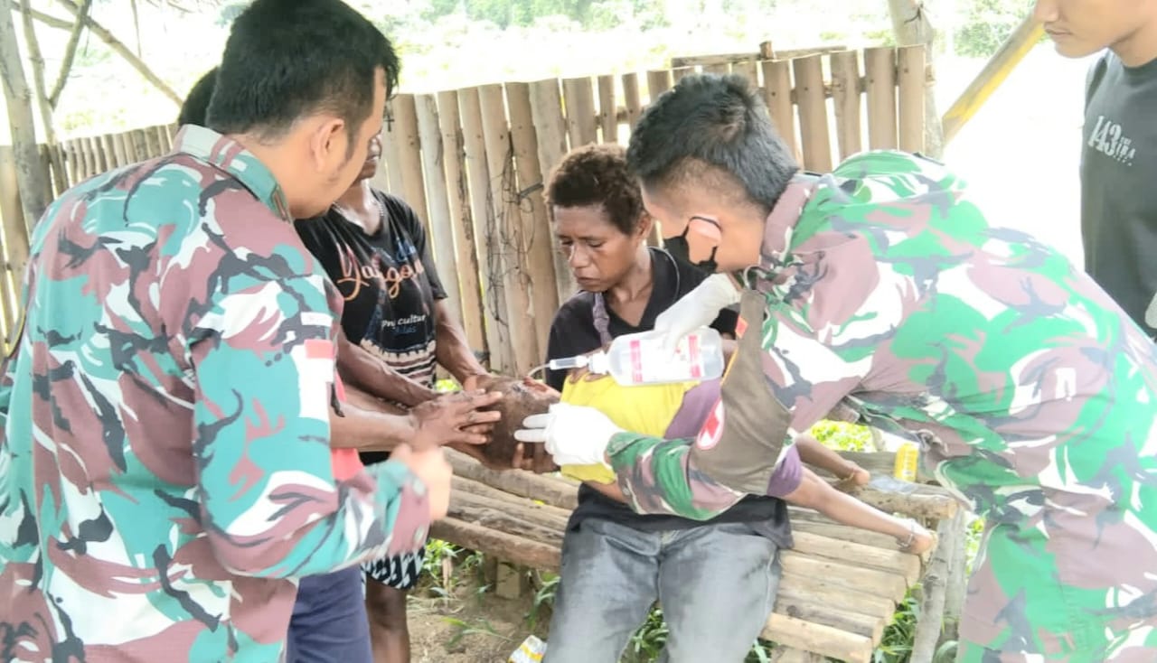 Mengetahui Balita Demam dan Infeksi Di Pedalaman Papua, Satgas Yonif 143/TWEJ Cepat Ambil Tindakan Medis